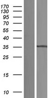 C17orf81 (ELP5) Human Over-expression Lysate