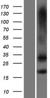 TMEM88 Human Over-expression Lysate