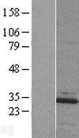 MBLAC2 Human Over-expression Lysate