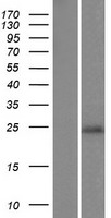 C9orf150 (LURAP1L) Human Over-expression Lysate