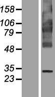 FITM1 Human Over-expression Lysate