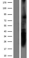 RPRML Human Over-expression Lysate