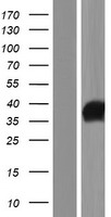IYD Human Over-expression Lysate