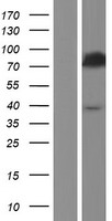 ACSL5 Human Over-expression Lysate