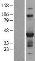 ZNF784 Human Over-expression Lysate