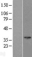 SPEM1 Human Over-expression Lysate