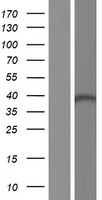 Dehydrodolichyl Diphosphate Synthase (DHDDS) Human Over-expression Lysate