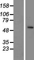 SLC24A5 Human Over-expression Lysate