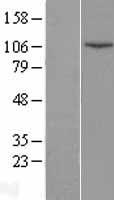 DNA Ligase IV (LIG4) Human Over-expression Lysate