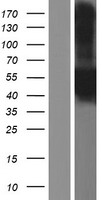 CA12 Human Over-expression Lysate