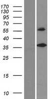 DEGS2 Human Over-expression Lysate