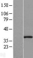Protein Phosphatase 1 beta (PPP1CB) Human Over-expression Lysate