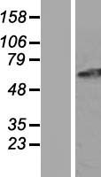 GPR152 Human Over-expression Lysate