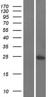 C16orf74 Human Over-expression Lysate