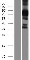 BICDL1 Human Over-expression Lysate