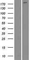 NUP210L Human Over-expression Lysate