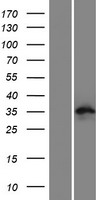 C9orf171 (CFAP77) Human Over-expression Lysate