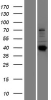 SEPTIN14 Human Over-expression Lysate