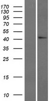 GADL1 Human Over-expression Lysate