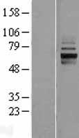 ANKRD13D Human Over-expression Lysate