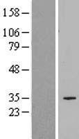 SLC25A34 Human Over-expression Lysate