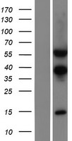 TSEN54 Human Over-expression Lysate