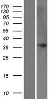 FAM43B Human Over-expression Lysate