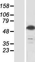 CSN1 (GPS1) Human Over-expression Lysate
