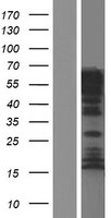 MAP6 Human Over-expression Lysate