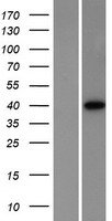 PRKACA Human Over-expression Lysate