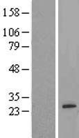 Amelotin (AMTN) Human Over-expression Lysate