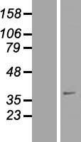 SFXN4 Human Over-expression Lysate