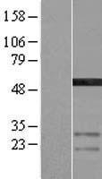 AMSH (STAMBP) Human Over-expression Lysate