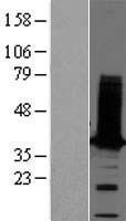 Tropomyosin 2 (TPM2) Human Over-expression Lysate