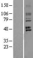 GPR 150 (GPR150) Human Over-expression Lysate
