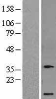 Osteocrin (OSTN) Human Over-expression Lysate