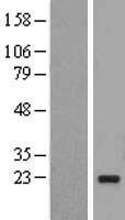 UBE2I Human Over-expression Lysate