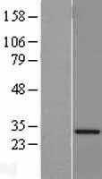 VAPA Human Over-expression Lysate