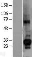 CTDSP1 Human Over-expression Lysate