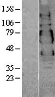 VSIG1 Human Over-expression Lysate