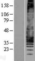Leukotriene B4 Receptor (LTB4R) Human Over-expression Lysate