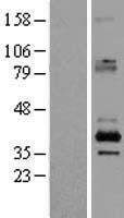 SFXN2 Human Over-expression Lysate