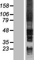 Signal Peptide Peptidase (HM13) Human Over-expression Lysate