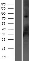 RSPO2 Human Over-expression Lysate