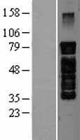 PAK5 Human Over-expression Lysate
