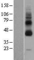 GPR119 Human Over-expression Lysate