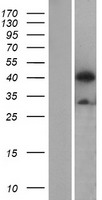 ATG4B Human Over-expression Lysate