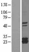 Mitochondrial Ferritin (FTMT) Human Over-expression Lysate