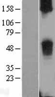 TAS2R38 Human Over-expression Lysate