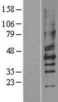 P2Y2 (P2RY2) Human Over-expression Lysate